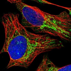 PNPT1 Antibody, Novus Biologicals 0.1mL; Unlabeled:Antibodies, Polyclonal